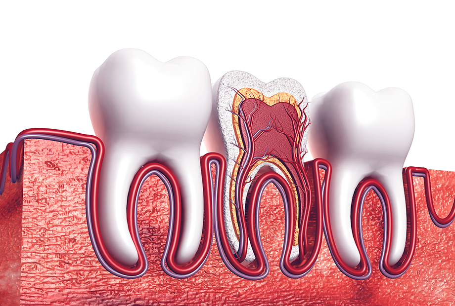 歯を残すための根管治療